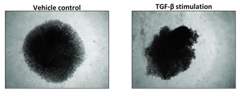 Epithelial 3D spheroids provide an in-depth understanding of drug sensitivity-1