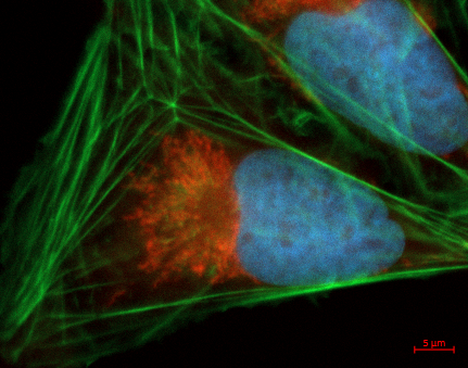 CP02_Microplate Selection_Pillar Page_Cells