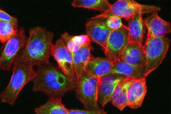 CP03_Imaging_Decision_02
