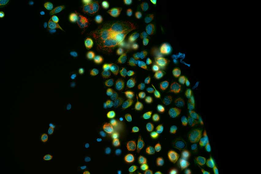 CP03_Imaging_Awareness_02